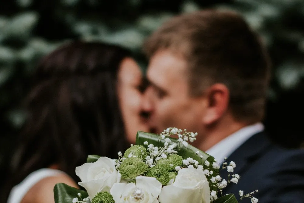 What Should You Do for Your Skin before a Wedding?